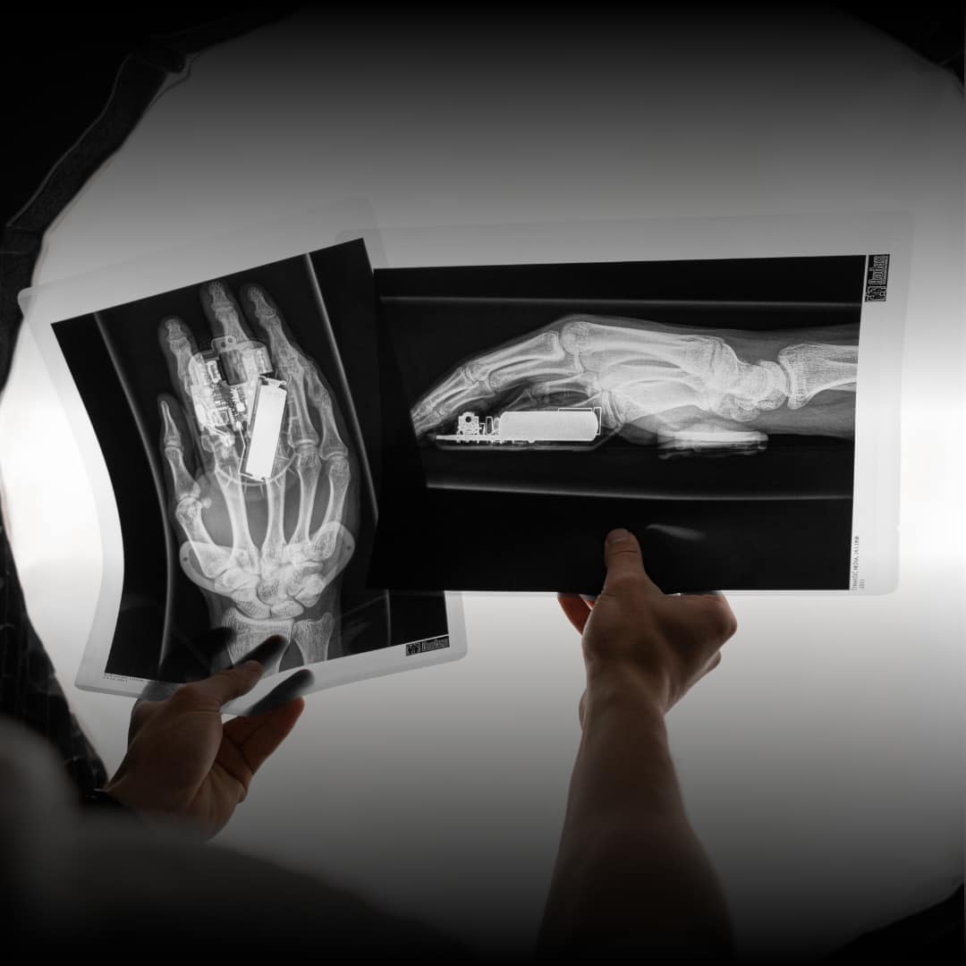 DeltaHub Carpio 2.0 radiografia